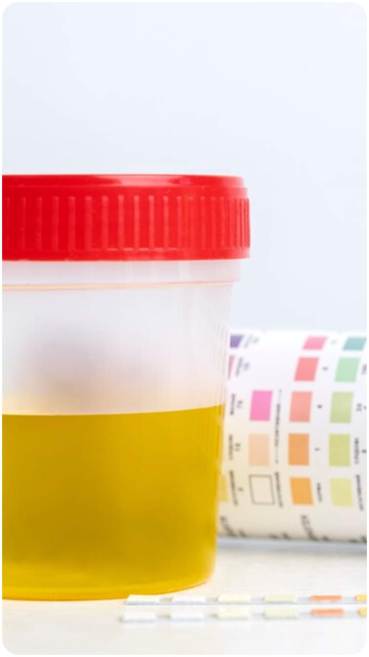 पेशाब का रंग