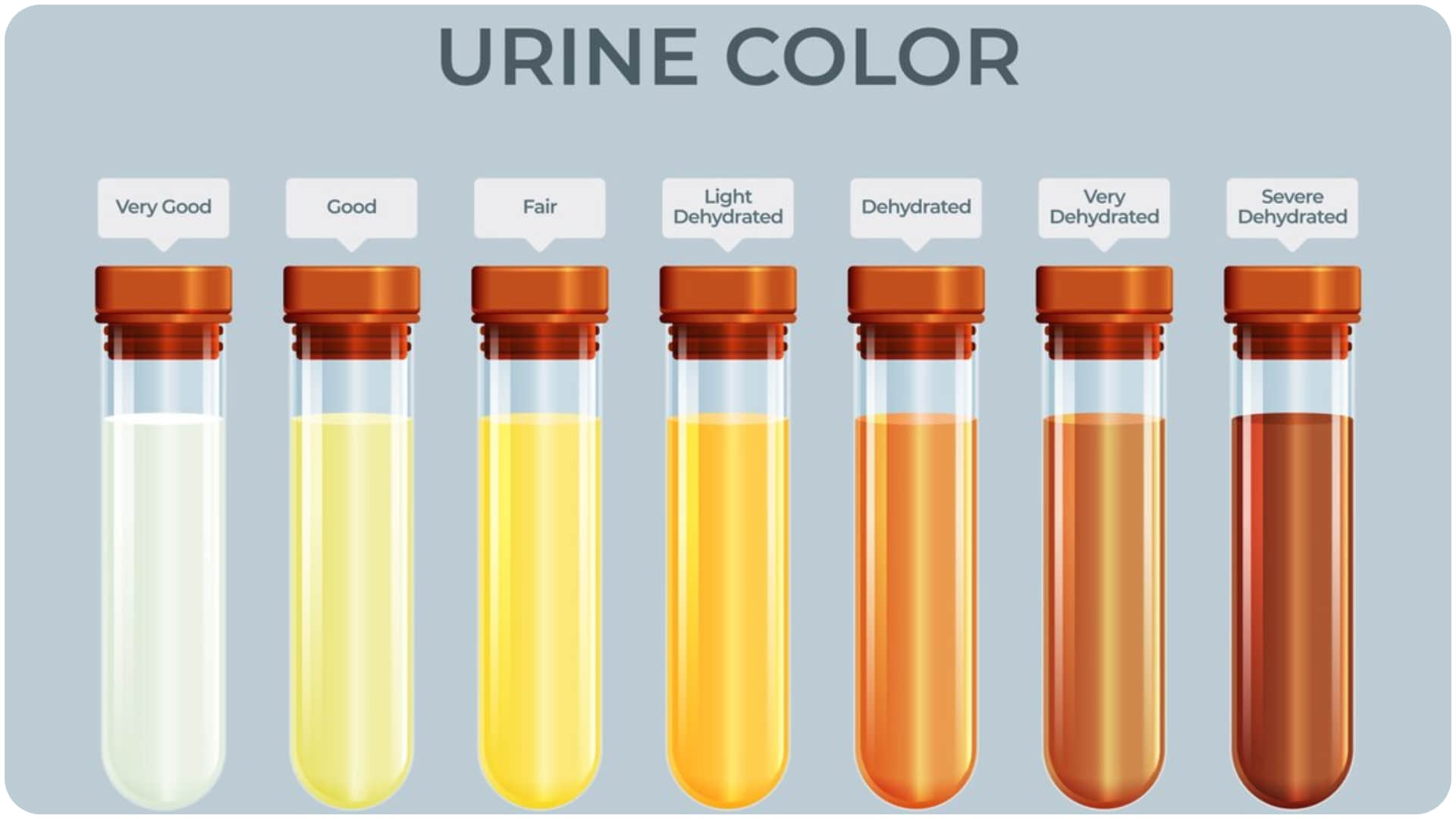 Dehydration Symptoms Key Warning Signs Your Body Shows When Lacking Water
