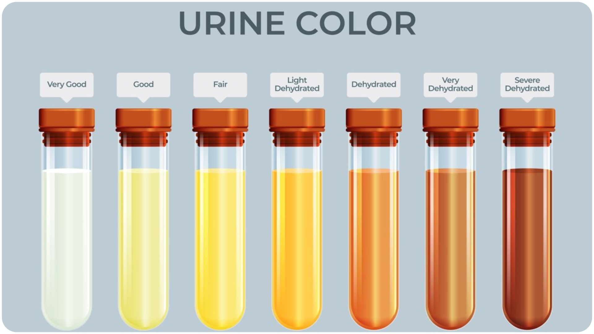 Dehydration Symptoms Key Warning Signs Your Body Shows When Lacking Water