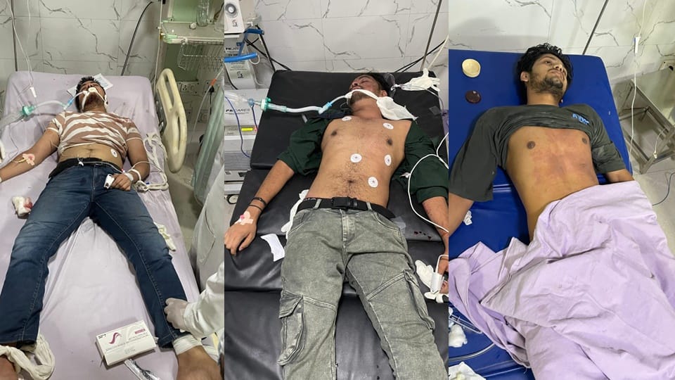 UP: Five students burnt due to lightning in TMU, shocking video from Moradabad