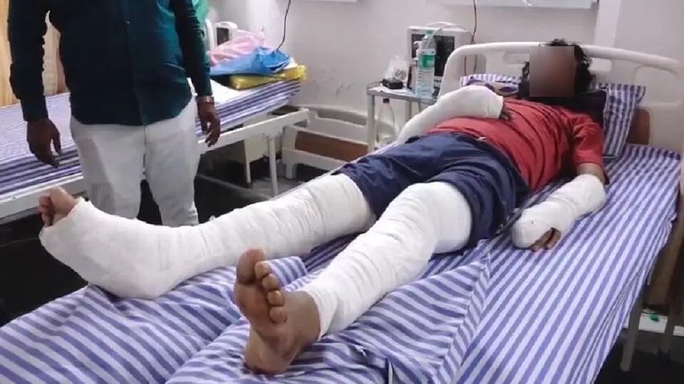 man followed his sister to her house brother and others broke his hands and legs
