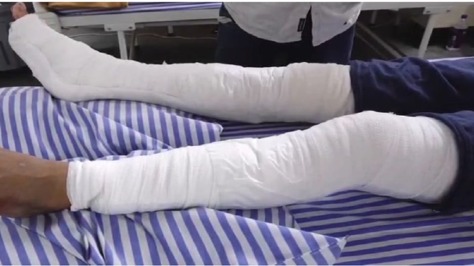 man followed his sister to her house brother and others broke his hands and legs