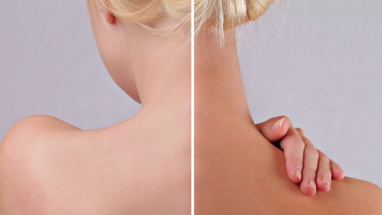 Skin care Tips Apply These Things Before Going Out To Prevent From Sunburn