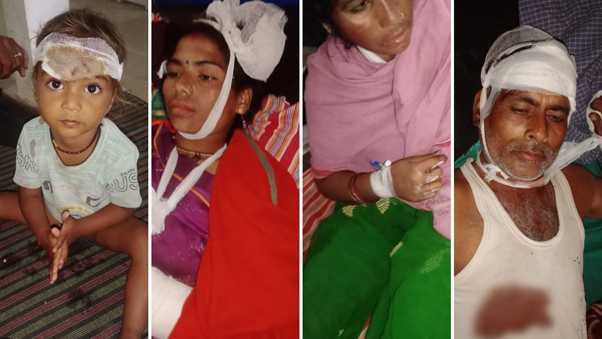 Chandauli News Entered house and family members beaten up four people injured case registered