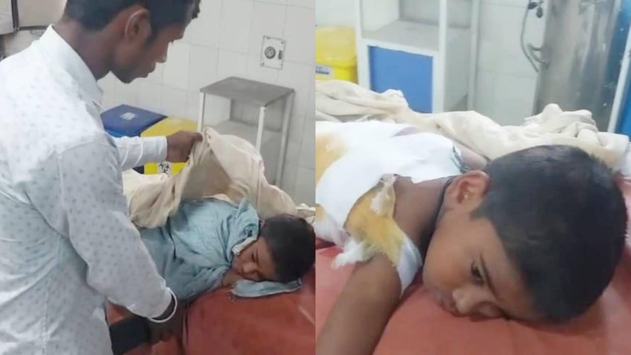 Bihar News Two school going children were bitten by dog in Samastipur one died other is undergoing treatment
