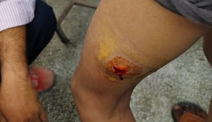 Kanpur Minor beaten up for not saying Jai Shri Ram glass broken and inserted in leg report filed