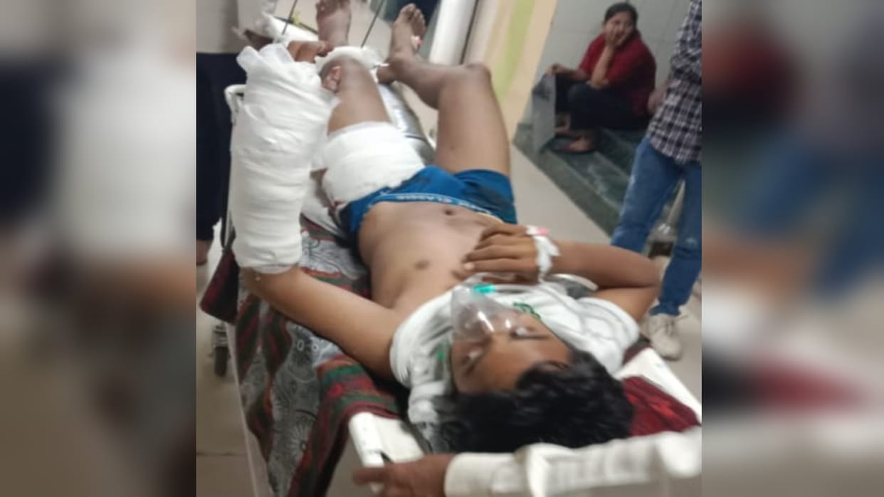 Teen gets shot in celebratory firing during Dwarchar, chaos ensues