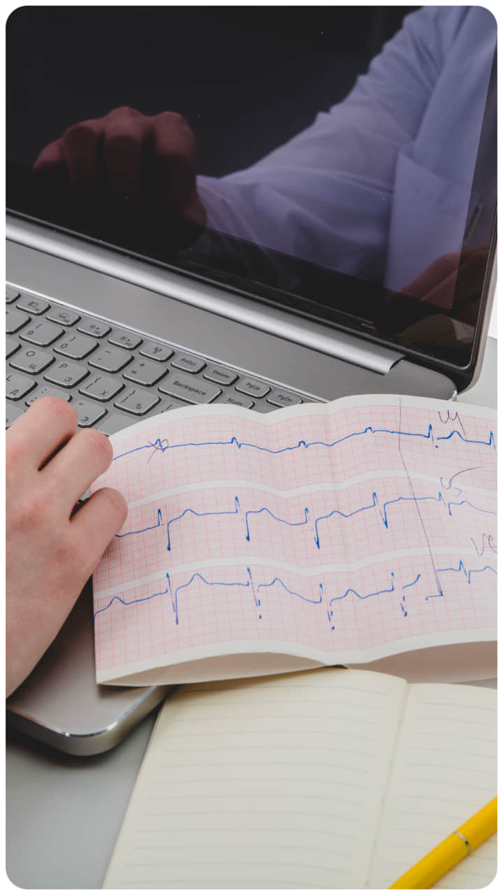 ईसीजी टेस्ट