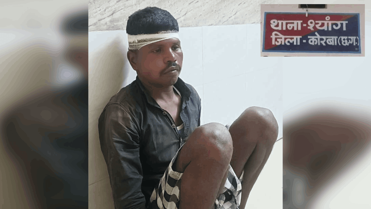 Attempt to rob a businessman with a country-made pistol in Korba
