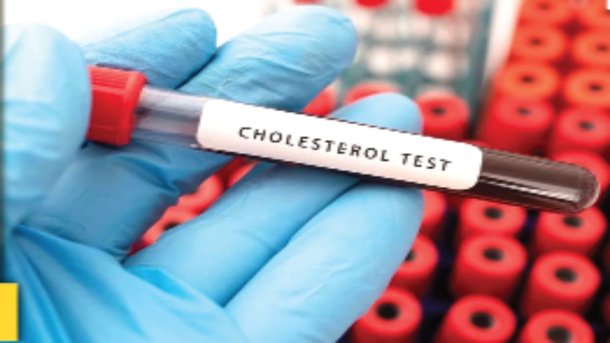 Cholesterol testing will now be very accurate, easy and affordable Indian scientists developed this technology