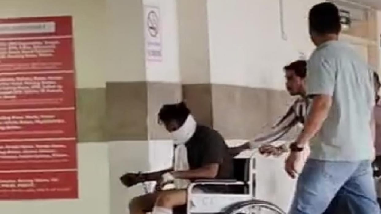 Encounter between criminals and police in Yamunanagar: Two were shot in the leg, the third escaped by dodging;