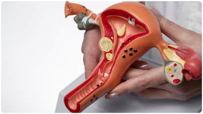 Women aged 35-55 in Himachal are at higher risk of cervical cancer, IGMC seeing patients annually