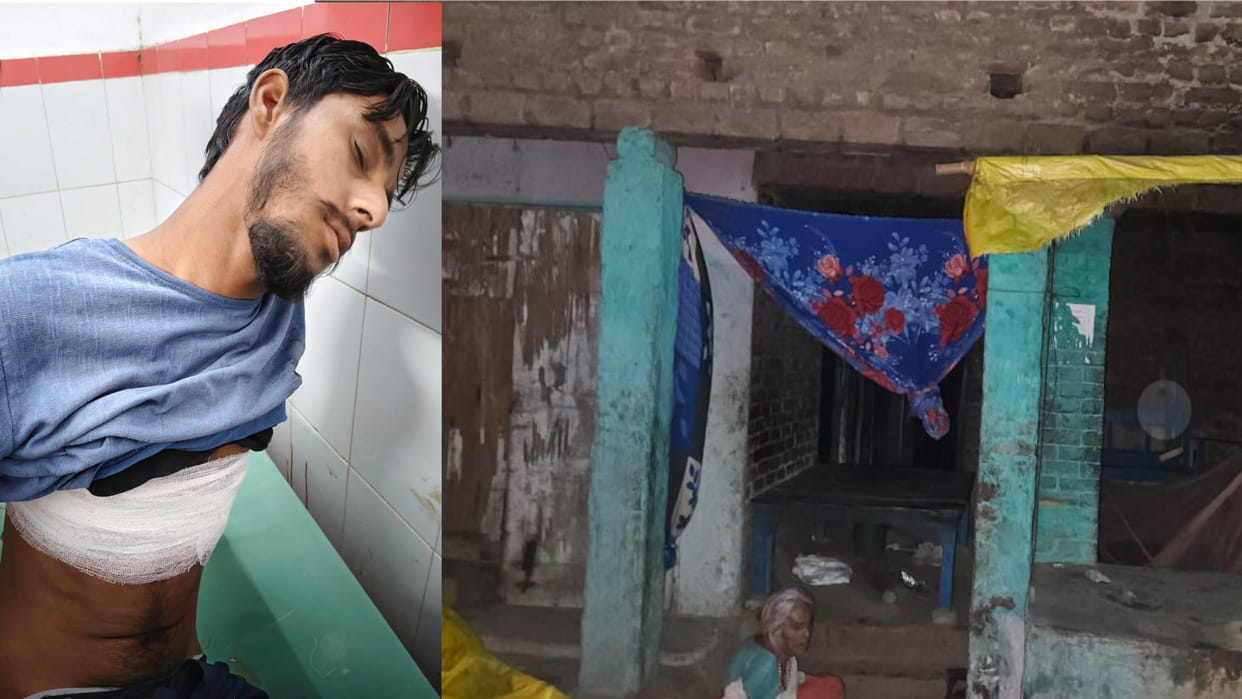 In a minor dispute, miscreants shot a young man in Chauri Chaura, Gorakhpur, his condition is critical