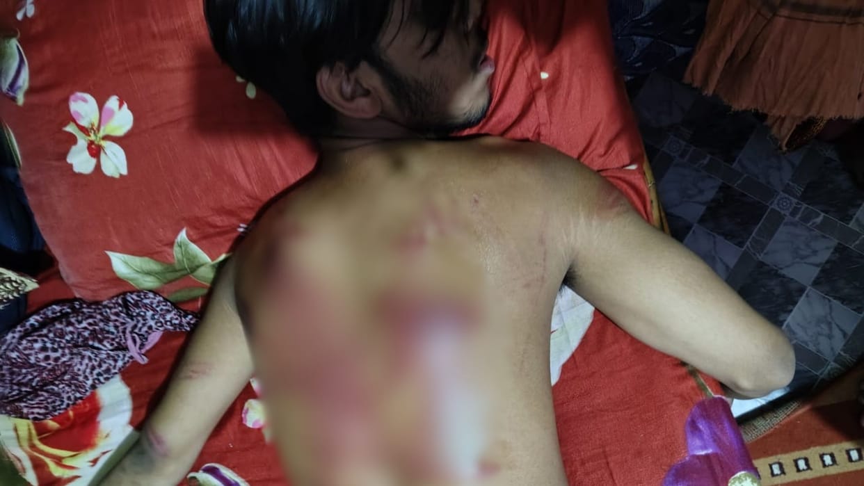 youth beaten up with belt and stick on suspicion of molestation in varanasi
