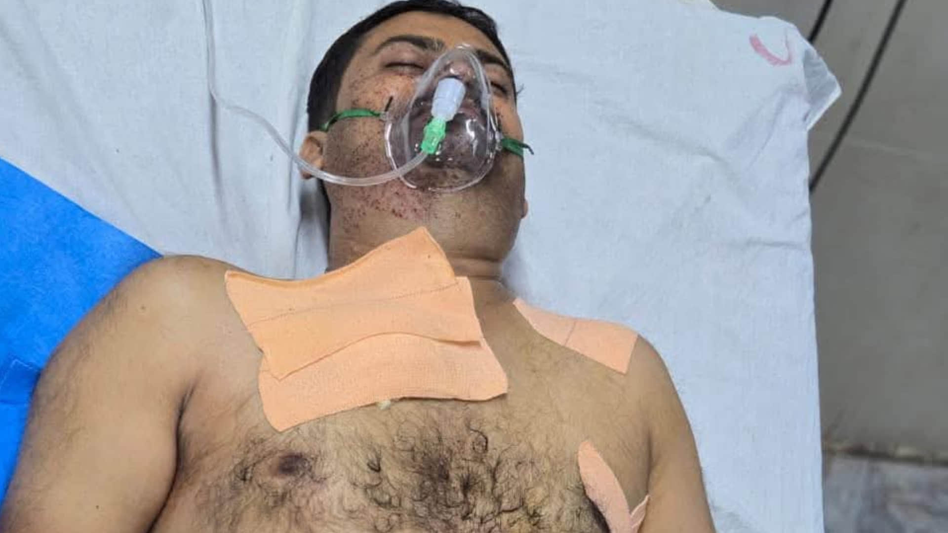 सतना में बदमाशों ने पुलिसकर्मी को गोली मार दी।