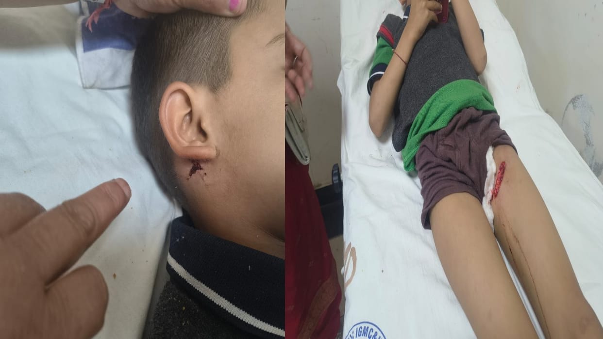 Stray dogs attacked three school children, two were left bleeding
