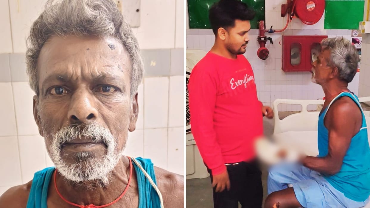 old man met family on Labor Day reached Kashi from Tamil Nadu hand cut off in train accident