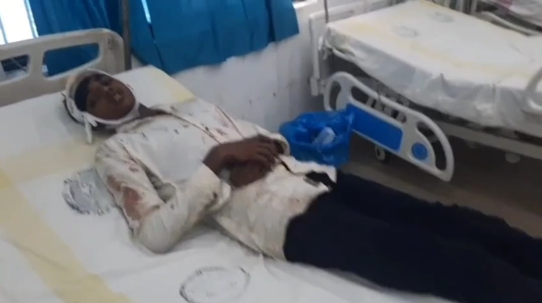 Bihar News: Bride brother seriously injured in fight during dance news in hindi
