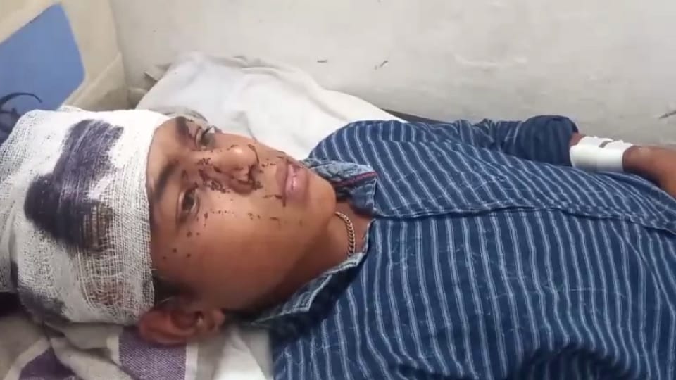 Bijnor: Leopards attacked a teenager and a youth, left both of them bleeding, people kept shouting