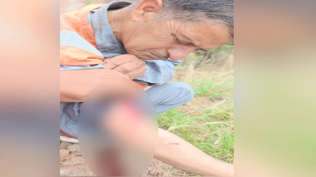 Shimla: A man walking home from the railway line was attacked by a langur and left bleeding, with deep wounds