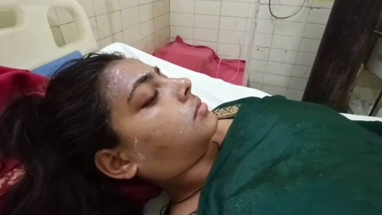Ayodhya: Cousin brother threw hot rice and dal on sister, her face and hands got burnt