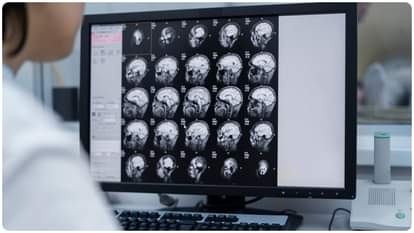 study says Men born in the summer are more likely to be depressed