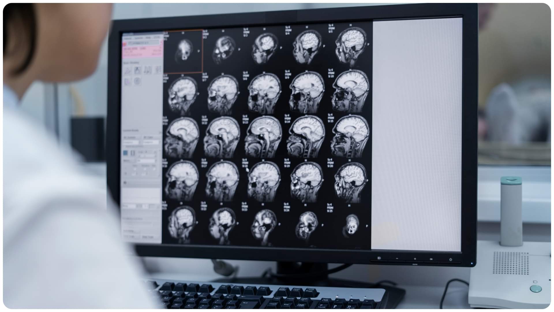 poor sleep causes premature brain ageing know how sleep deprivation affects brain health and function