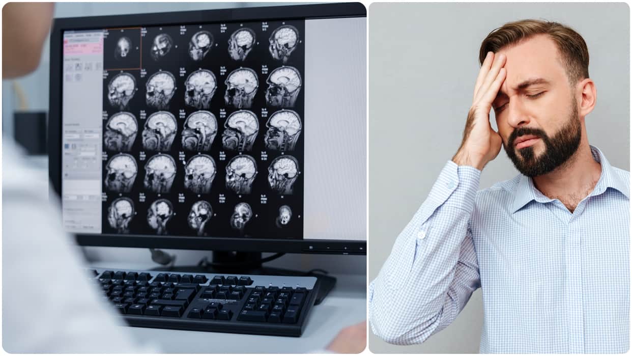 brain stroke worldwide cases know brain stroke symptoms and diagnosis