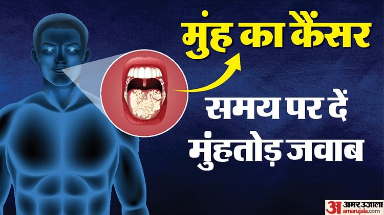 To Detect Mouth Cancer Aiims Launched An App In Collaboration With Iisc – Amar Ujala Hindi News Live