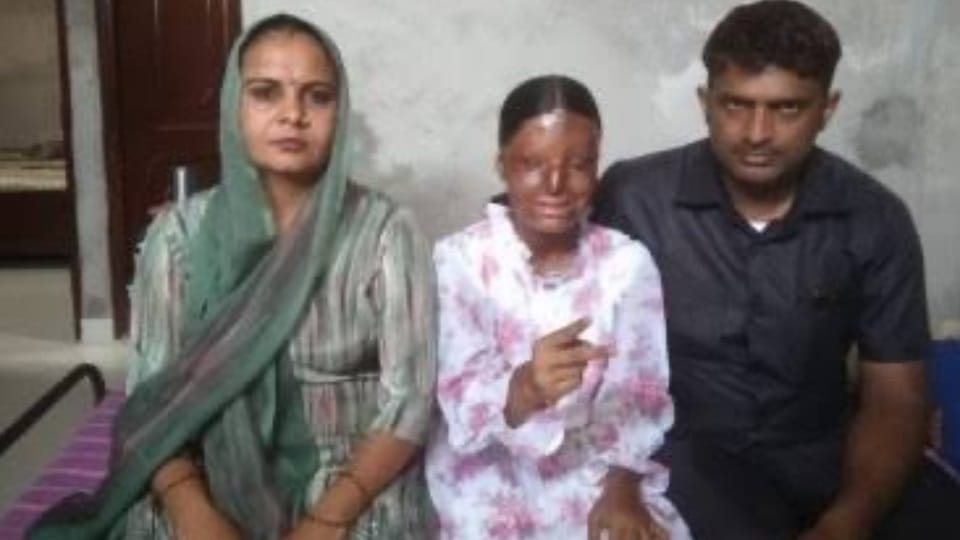 Kaafi victim of acid attack become school topper by scoring 95.6 percent marks in class 12th