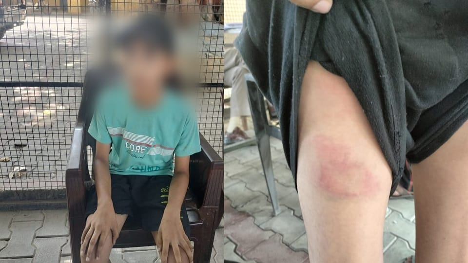 sixth class student was beaten by teacher in school for not doing homework