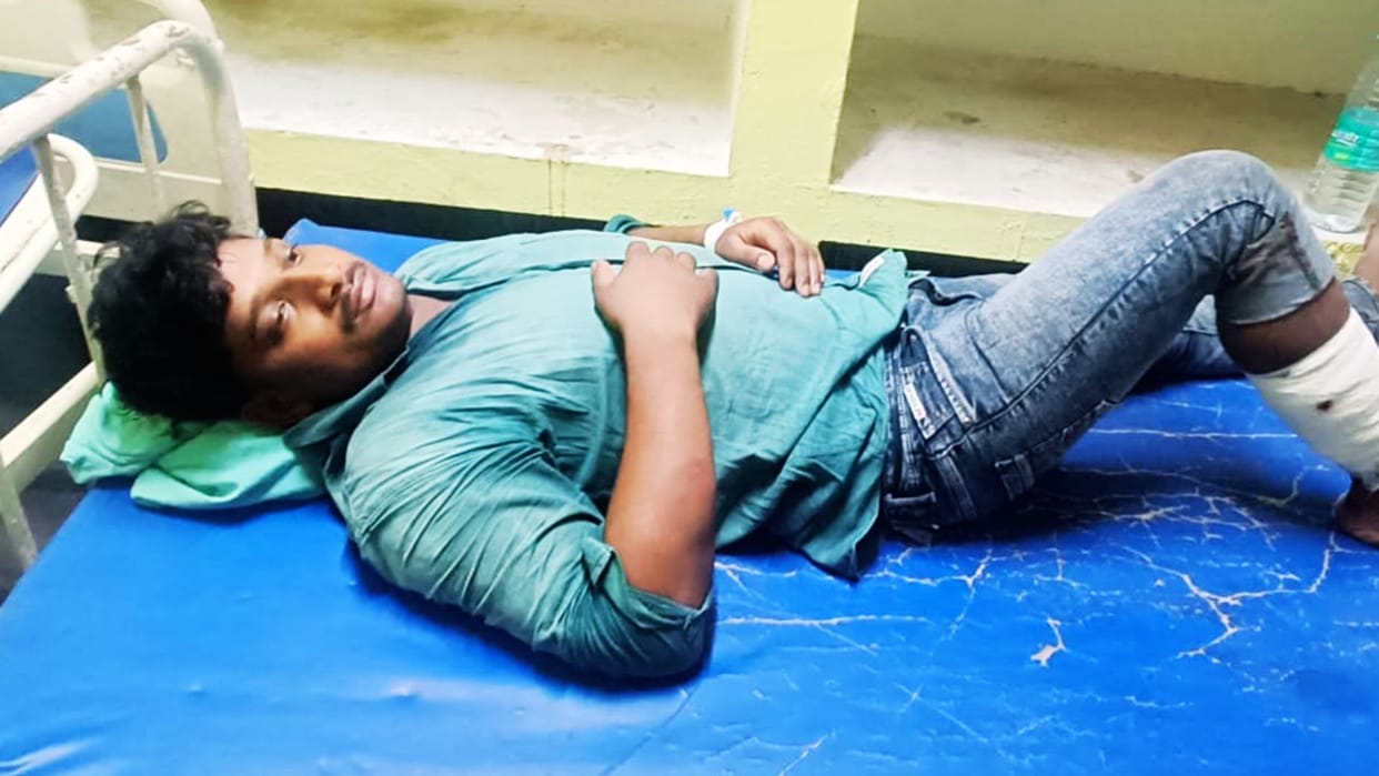 Encounter in Jaunpur Police shot miscreant he was smuggling meat pistol and cartridges recovered
