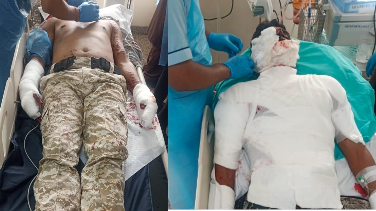 Bhopal News: Hand grenade exploded in 25th battalion in Bhopal, condition of two policemen critical