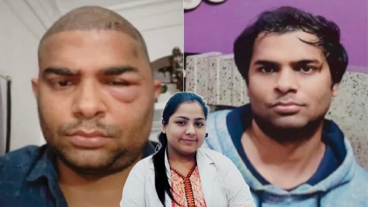 Hair Transplant Scam in Kanpur Shocking Deaths Linked to Dr Anushka Clinic Kanpur News