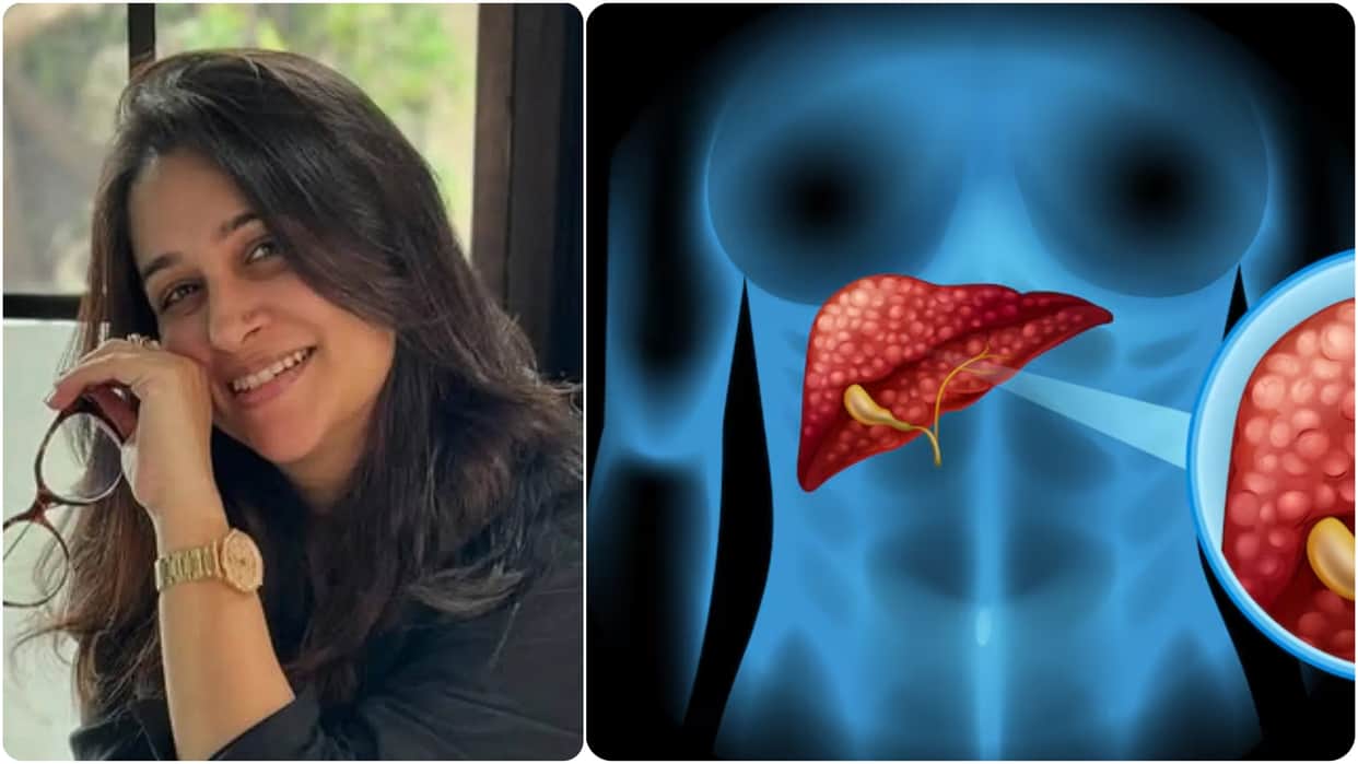 Dipika Kakar diagnosed with stage 2 liver cancer know its causes and early symptoms in hindi