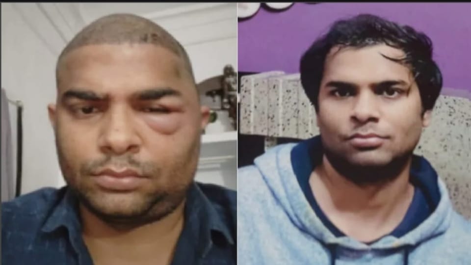 Kanpur: Dr Anushka, who did hair transplant, was traced in Rohtak