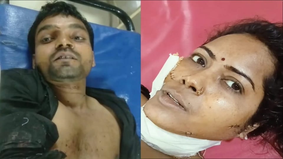 Husband and wife found bleeding in a hotel due to alcohol intoxication