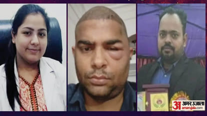 Hair Transplant Scam
