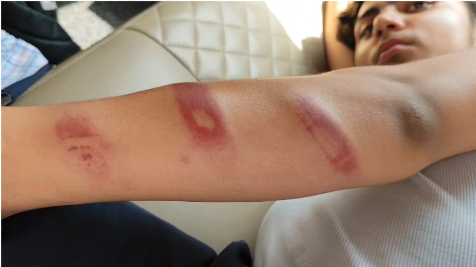 School operator beat the student with sticks in Firozpur