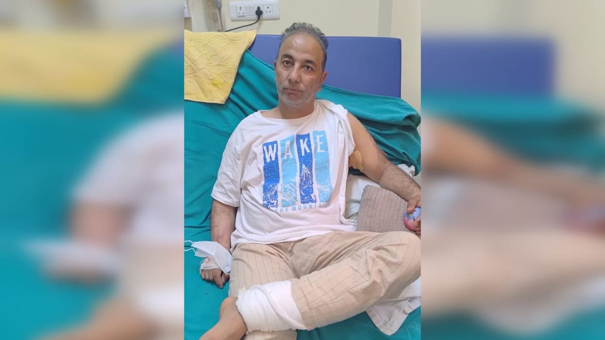 Rameez, the father of twins who were victims of shelling in Poonch, regained consciousness after 10 days
