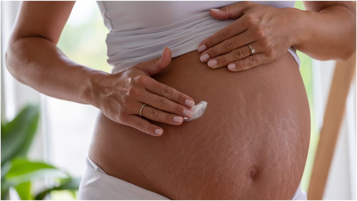 How to Get Rid of Stretch Marks on Belly After Pregnancy Check these Effective Remedies