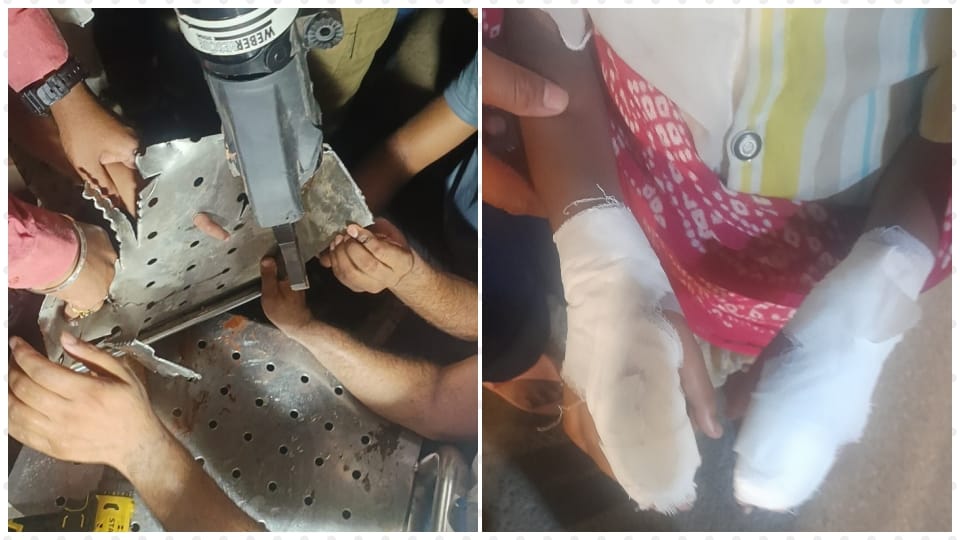 fingers of both hands of a girl got stuck in hole of bench