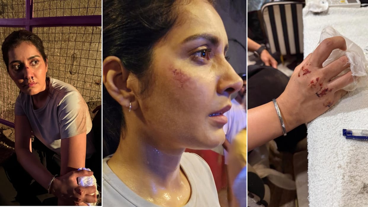 south actress Raashii Khanna post with blood wounded injured post on social says Your body breath bruises