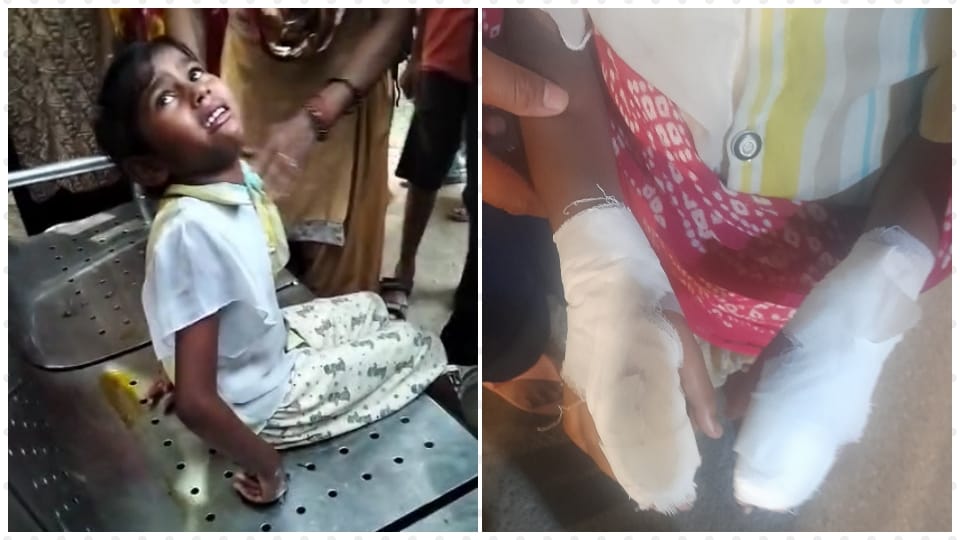 fingers of both hands of a girl got stuck in hole of bench