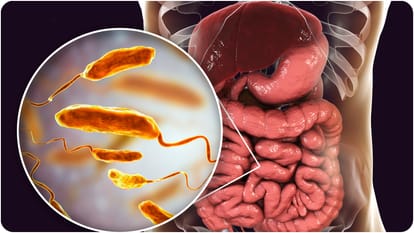 oral hygiene problems could increase your risk of developing heart disease and pancreatic cancer