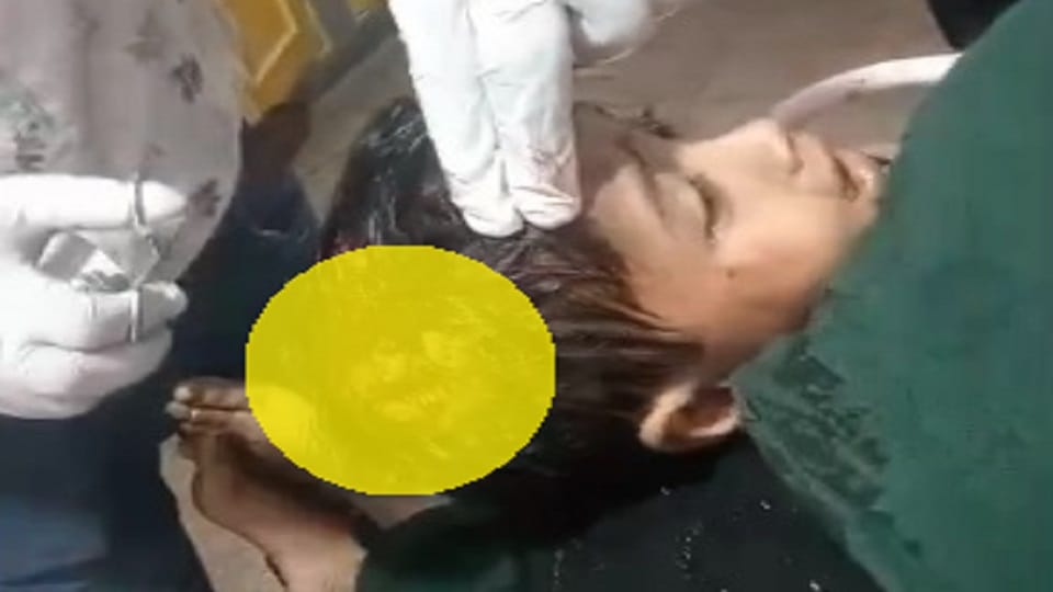 Shamli: Dogs took away a three-year-old girl from outside the house by clutching her jaws, she got 20 stitches