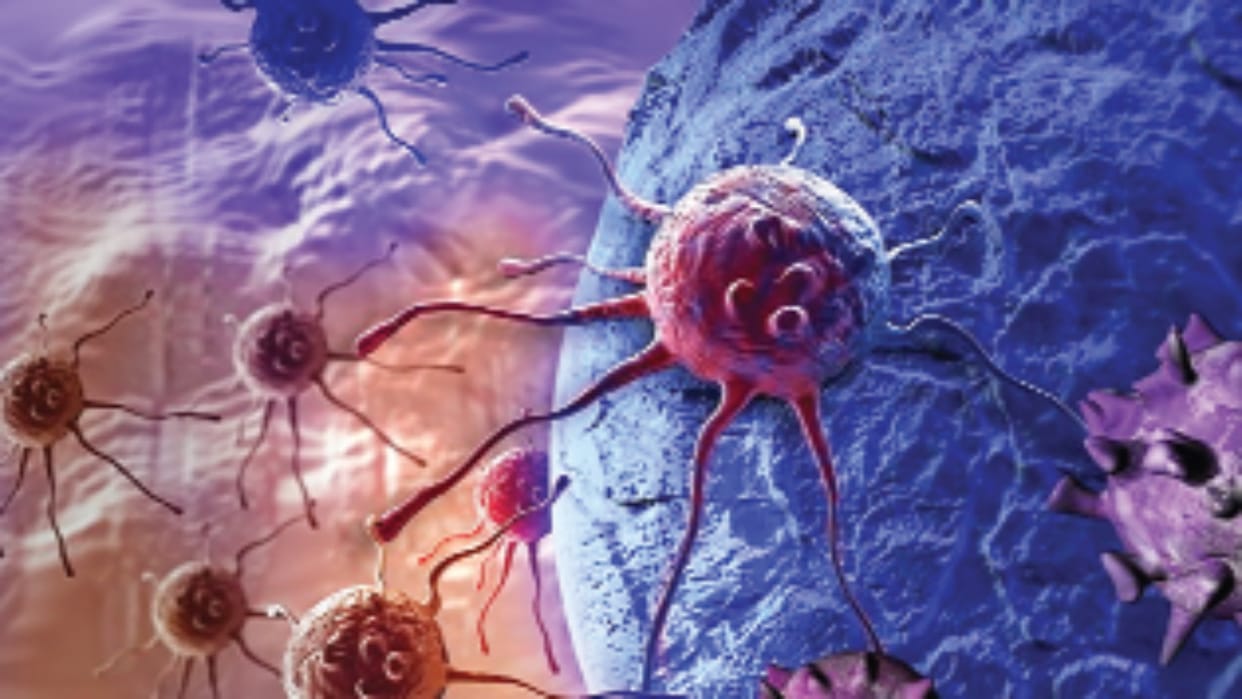 Himachal: Detecting colon cancer up to stage 2 can save lives, experts' study reveals