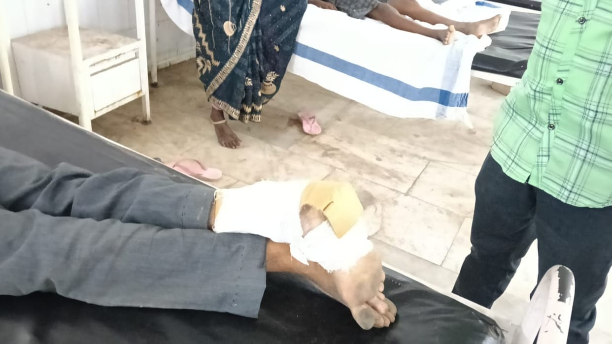 Muzaffarpur Bihar news :lackness health department fractured patient refer after leg fracture
