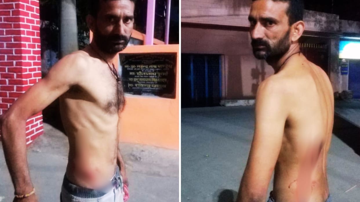 youth was first shot attacked with sharp weapon In Chandauli Outpost in-charge accused of harassment