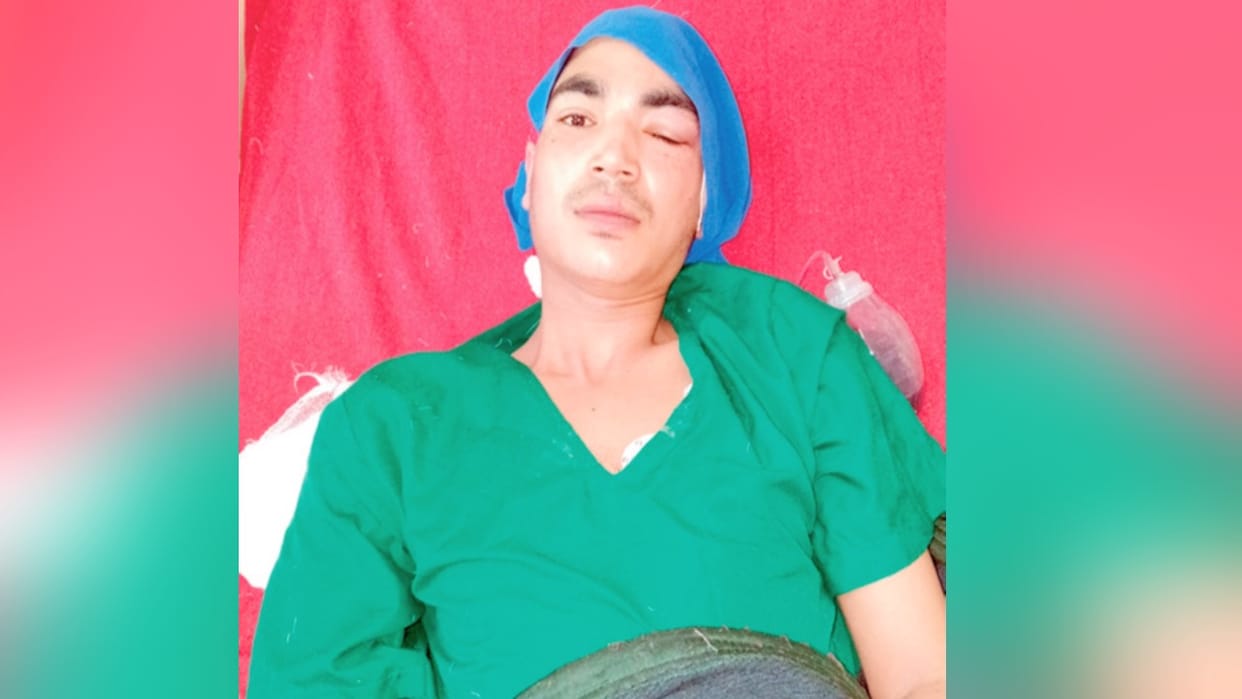 Neither ICU nor ventilator, still skull surgery was done; Kullu became the first district hospital